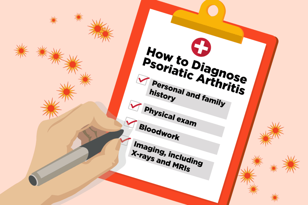 psoriatic-arthritis-diagnosis-how-doctors-diagnose-psoriatic-arthritis